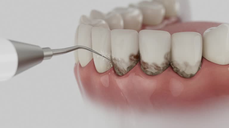 Trusted Teeth Cleaning And Checkup service in Agua Dulce, TX - Dentist Open Now
